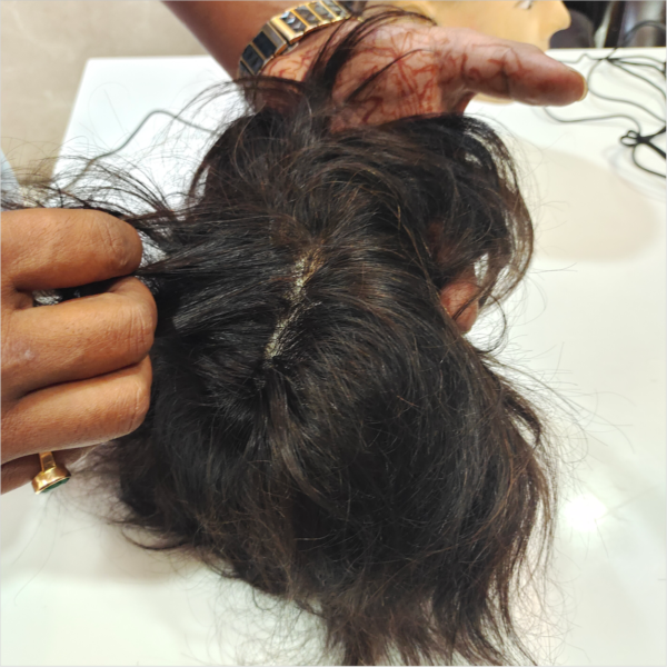 Skin Based Hair Patch