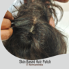 Skin Based Hair Patch