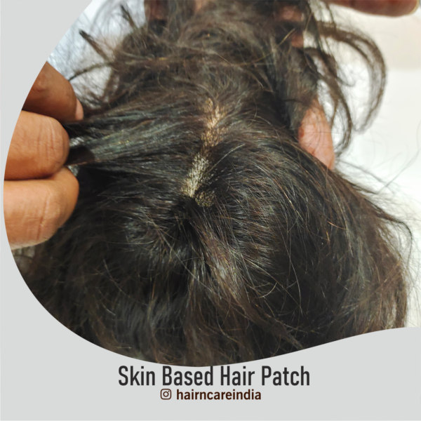 Skin Based Hair Patch